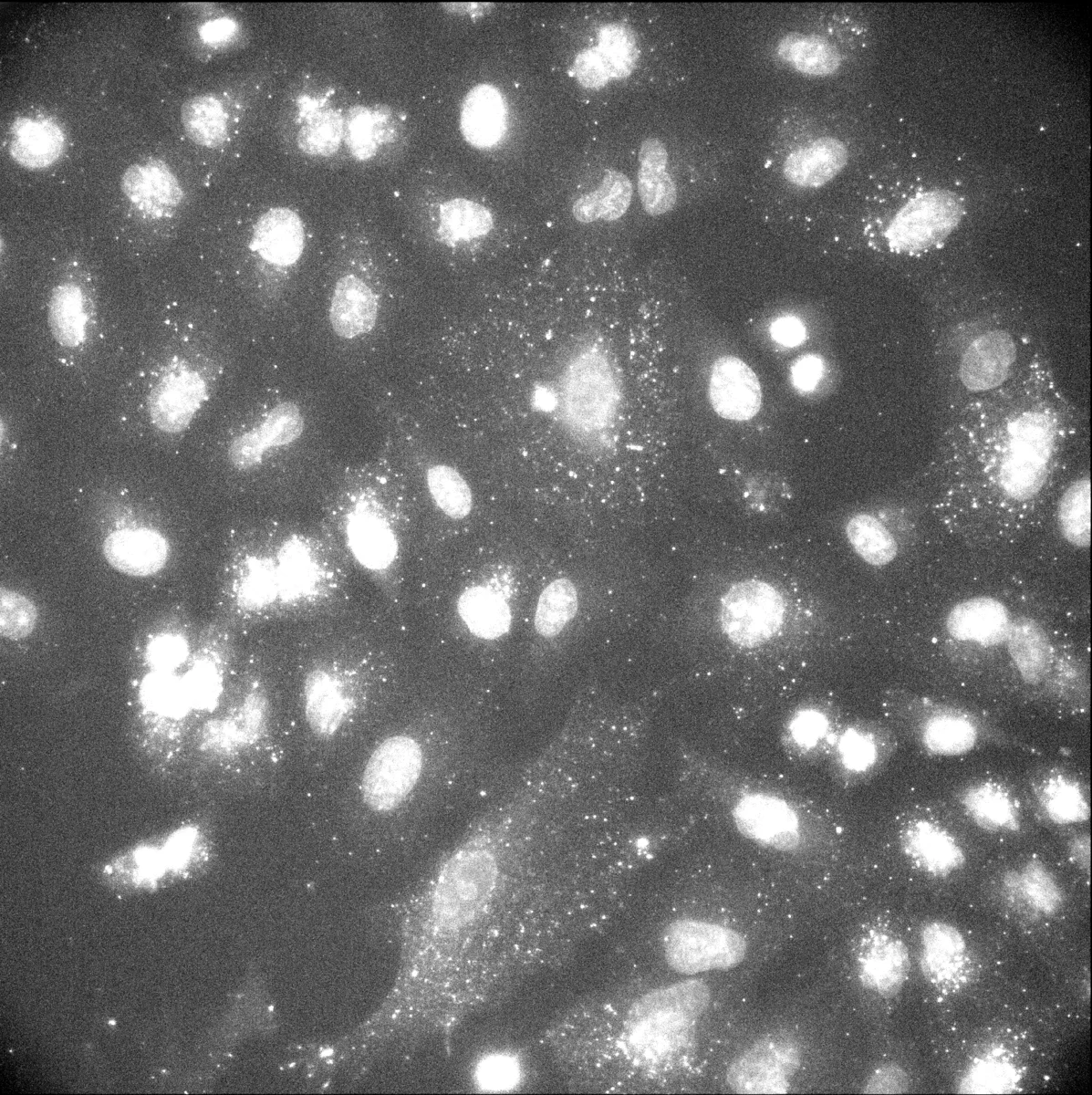 Raw: unprocessed fluorescence microscopy image before analysis